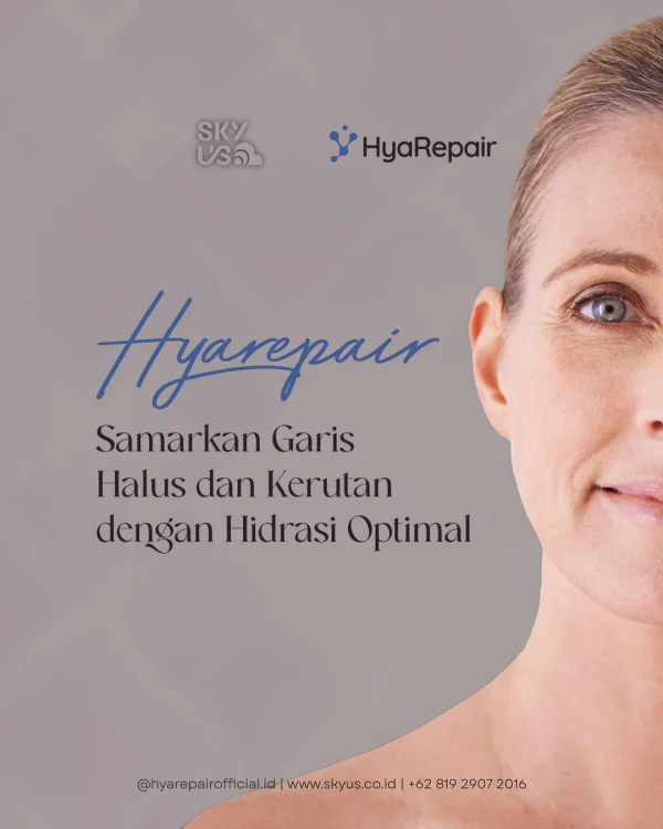 484216411_122198933762253544_2991152766941383822_n14